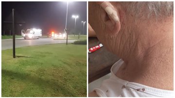 Atingido por estilhaços, idoso sofreu escoriações leves no rosto e orelha enquanto era socorrido - Imagens: Aconteceu em Bertioga / Sistema Costa Norte