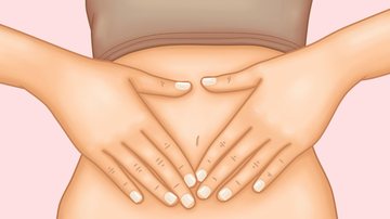 Doença crônica afeta mulheres em idade reprodutiva, ela geralmente é diagnosticada em mulheres com idade entre 25 e 35 anos - Imagem ilustrativa por Pixabay