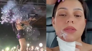 A artista ficou com o rosto todo machucado e está em recuperação DJ Flavinha Mulher atirando um canhão de confetes na cara ao lado esquerdo e do lado direito ela com o rosto machucado - Reprodução